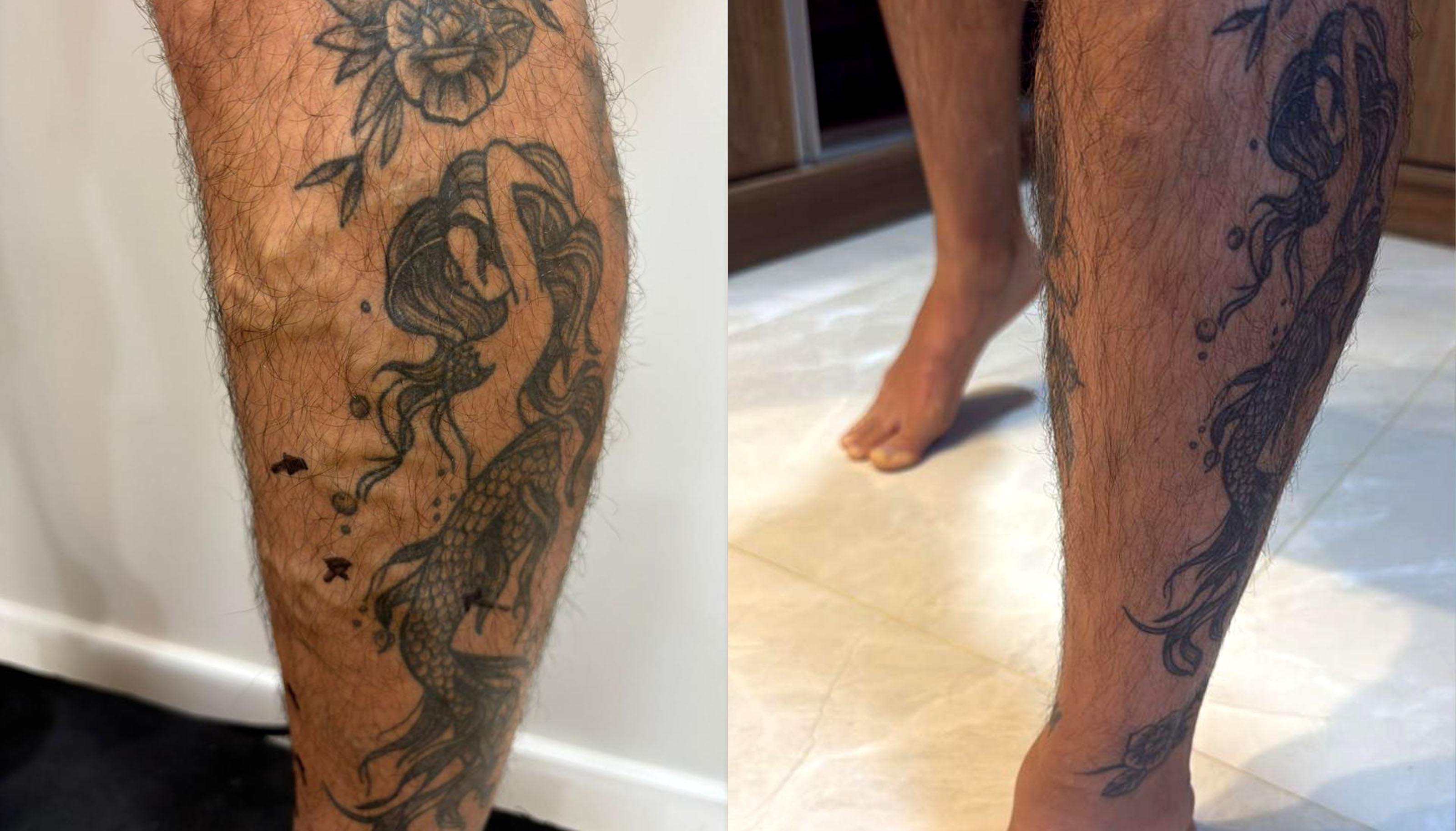 Caso 02 — Antes e Depois